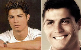 Xem khuôn mặt Ronaldo biến đổi "ảo diệu" sau 10 năm