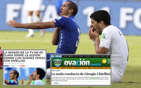 Báo chí Uruguay bênh Suarez, tố vết cắn chỉ là sản phẩm của... photoshop
