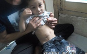 Xót xa cậu bé dân tộc Thái 5 tuổi chờ chết trên giường bệnh
