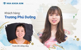 Thay đổi nhan sắc ngoạn mục nhờ niềng răng