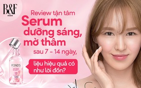 Review tận tâm serum dưỡng sáng, mờ thâm sau 7 - 14 ngày, liệu hiệu quả có như lời đồn?