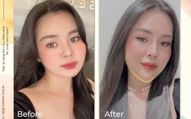 Top 3 liệu trình tạo hình V-Line Hàn Quốc với thẩm mỹ viện Muse Clinic