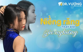 Cô bé “lãi” góc nghiêng vạn người mê nhờ niềng răng