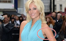 Pixie Lott quên "dọn dẹp" vùng cánh tay