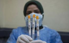 F1 của Giám đốc Hacinco sau tiếp xúc 1 ngày đã dương tính: Là bình thường hay virus đang lây nhanh "siêu kinh khủng"?