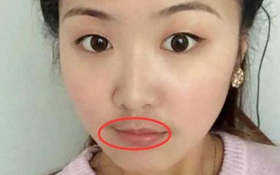 4 biểu hiện trên khuôn mặt cho thấy tử cung đang có vấn đề