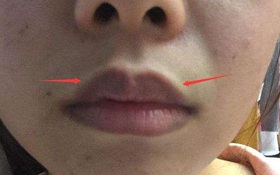 2 bộ phận trên cơ thể nữ giới càng thâm đen thì tử cung càng nhiều chất độc, cần làm ngay 2 việc và ăn 2 thứ