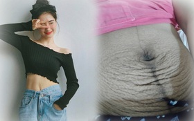 Các mẹ bầu đồng loạt khoe bụng đầy vết rạn thâm đen dưới bài đăng của Hòa Minzy: Những dấu tích của sự hi sinh, của tình yêu thương vô bờ bến