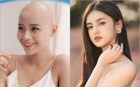Vụ cô gái ung thư thi Miss World Việt Nam: Ekip xin lỗi vì ghi nhầm danh hiệu, động thái "Hoa khôi real" gây chú ý