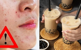 WHO cảnh báo: 3 thực phẩm khiến bạn già đi trông thấy