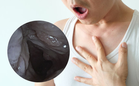 Người đàn ông ho ra máu kèm khó thở: Bác sĩ cảnh báo loại bệnh thường gặp