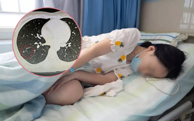 Cô gái trị mồ hôi tay lại vô tình phát hiện ung thư phổi, bác sĩ nhắc nhở những thói quen sinh hoạt của người trẻ