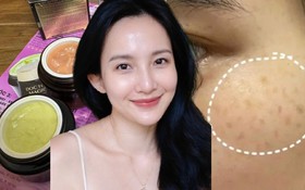 Kem trị nám trôi nổi đang phá hủy da nhiều người mua “nhẹ dạ”