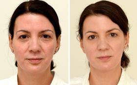 Thử nghiệm uống đủ lượng nước này trong 4 tuần, người phụ nữ 4x trẻ ra 10 tuổi