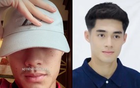 Tình hình của thủ môn Trung Kiên