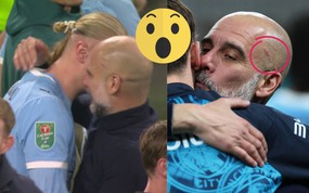 Vì sao HLV Pep Guardiola lại tự cào rách đầu khi Man City quật ngã Arsenal?