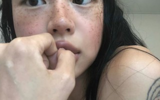 Cảnh báo: Nữ giới có 4 vùng này trên cơ thể càng "đen" chứng tỏ tử cung càng chất nhiều độc tố