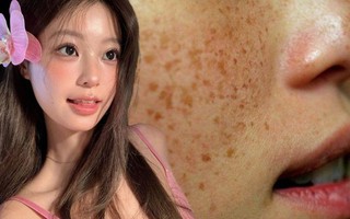 Hầu hết chị em đang bôi kem chống nắng kiểu này, bảo sao da sạm nám và nhăn nheo thấy rõ vào mùa hè