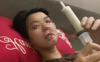 Hình ảnh cô gái mắc ung thư xương hàm, bữa ăn hàng ngày là "cháo xay loãng ăn bằng xi lanh" gây xót xa: Dấu hiệu phát hiện bệnh sớm trước khi quá muộn