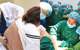 Mổ lấy thai cho sản phụ Phú Thọ nặng 178kg, không thể gây tê tủy sống vì lớp mỡ dày hơn 11cm