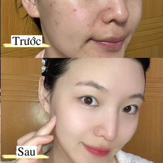 6 sữa rửa mặt được đánh giá cao vì khả năng làm sạch sâu mà không làm khô da