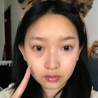 4 dưỡng mắt "made in Vietnam" giúp giảm quầng thâm thấy rõ