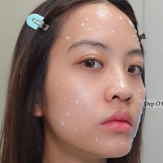 Serum vi kim: Bôi lên là thấy châm chích nhẹ, da cải thiện thấy rõ nhưng cần thời gian làm quen