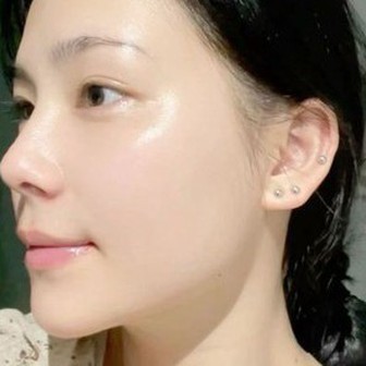 5 lọ serum se nhỏ lỗ chân lông hiệu quả, chăm bôi thì da cứ mướt rượt