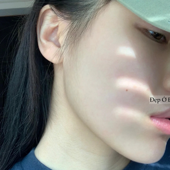 Ngừng "bôi cả thế giới lên mặt": Cô nàng này khiến cho da đẹp hơn chỉ nhờ vài bước cơ bản