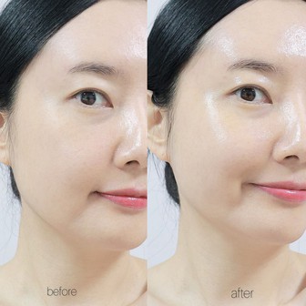 5 thói quen đơn giản giúp da "lâu già", càng làm sớm càng có lợi