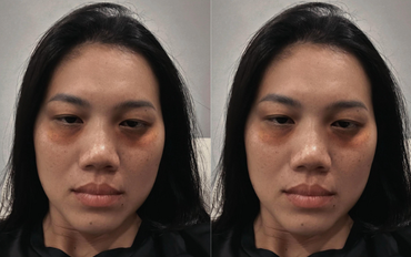 Dụi mắt không nhận ra Ánh Viên, sao lại ra nông nỗi này?