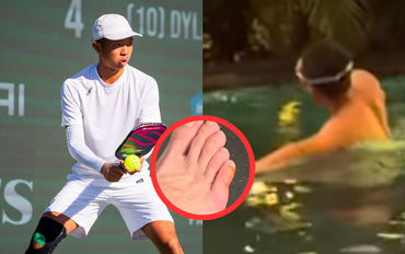 Quang Dương ngâm nước 36 tiếng xử lý chân phồng rộp, bác sĩ thể thao lên tiếng