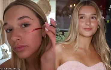 Tiểu thư Harper Beckham dậy thì mặt đầy mụn vì skincare sai cách, làm cả slide thuyết trình xin Victoria... được uốn tóc