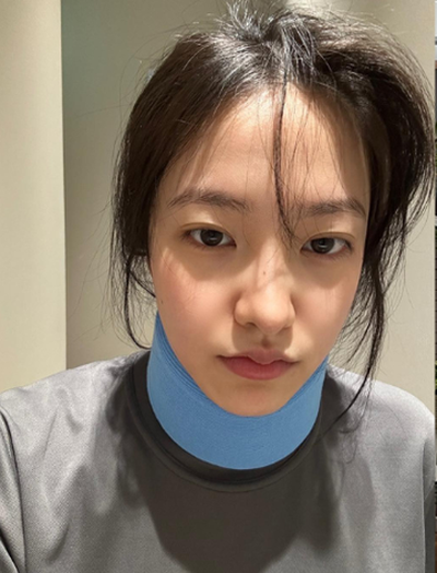 Nữ idol gãy cổ vì tập pilates