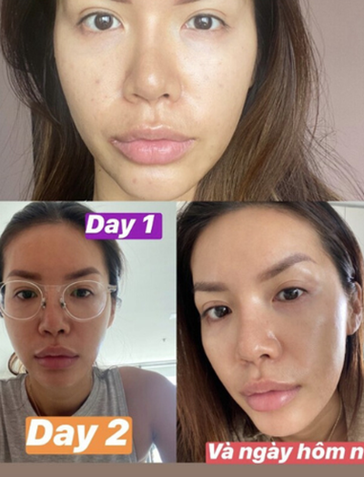 Minh Tú tuổi 34 phục hồi da thành công, mặt căng bóng rạng rỡ nhờ loại nước có nguyên liệu bán đầy ngoài chợ