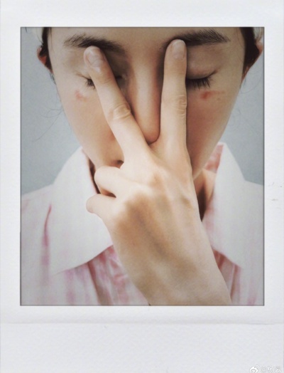 Dương Mịch bỏng mắt vì dùng mặt nạ hot