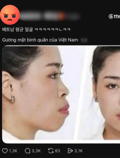 Người đẹp lột xác thành công nhờ "dao kéo" vướng lùm xùm liên quan đến miệt thị ngoại hình người Việt