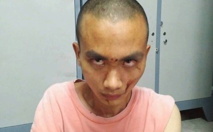 Nghi vấn đối tượng truy sát nhiều người trong chùa Bửu Quang có sử dụng chất kích thích