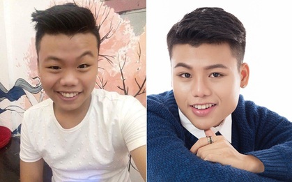 Cậu bạn 17 tuổi với quyết định "đập mặt làm lại" và màn lột xác khiến ai cũng ngỡ ngàng
