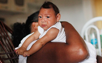 Dịch Zika xuất hiện ở thai phụ Việt Nam: Dấu hiệu bệnh và cách phòng tránh