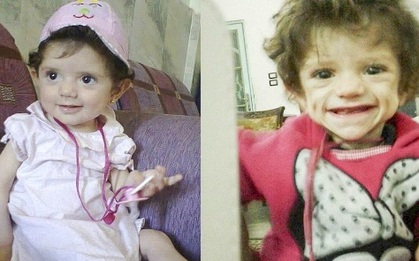 Đau lòng trước hình ảnh những đứa trẻ bị IS bỏ đói đến chết tại Syria