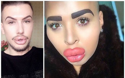 2 phiên bản của Kim Kardashian cãi nhau chí chóe trên Facebook về việc phẫu thuật thẩm mỹ