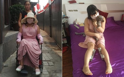 Hậu quả kinh hoàng của cô gái "cuồng dao kéo nhất Trung Quốc" với 200 lần phẫu thuật thẩm mỹ