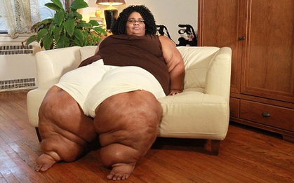 Để miêu tả đôi chân này, chỉ có "chân cột đình" là hợp lý nhất