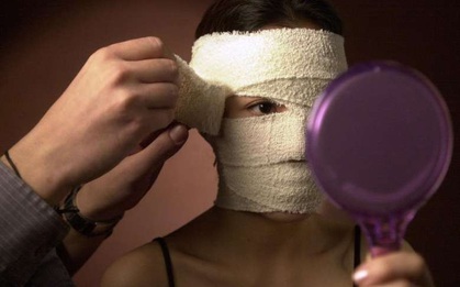 Những mặt trái của phẫu thuật thẩm mỹ - khi ngành công nghiệp sắc đẹp đi quá giới hạn