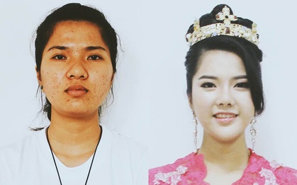 Cô gái bị nhiễm trùng da được "lột xác" để trở thành ca sĩ