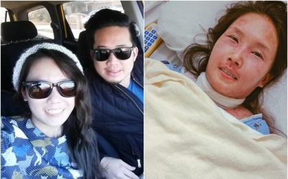 Ông bố chụp bộ ảnh "Ba kể con nghe": Bệnh Lupus làm vợ tôi già đi, tóc rụng, và tôi vẫn yêu cô ấy
