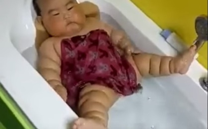 Sự thật bất ngờ đằng sau hình ảnh em bé bụ bẫm người nần nẫn ngấn