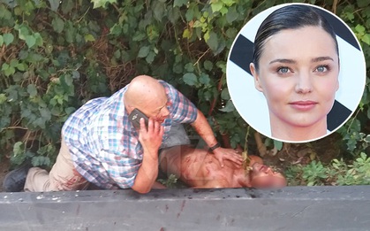 Kẻ đột nhập nhà Miranda Kerr máu me bê bết vì bị vệ sĩ bắn 4 phát