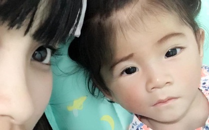 Bé gái Lào Cai 14 tháng tuổi chỉ nặng 3,5 kg hiện đã được 6 kg và hồng hào hơn